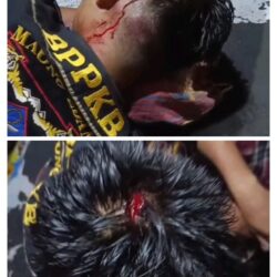 Korban Pengeroyokan di Kafe Sakura, Cikarang Barat, Keluhkan Lambatnya Penanganan Kasus oleh Polres Metro  Bekasi Kota